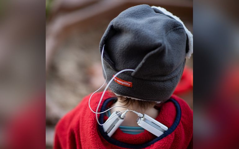 back of child's head showing hat and magnets for cochlear implants